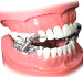 Dental Instrument