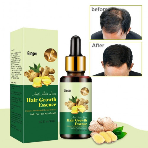 Ginger Hair Growth Essence Oil Price in Bangladesh | Bdstall