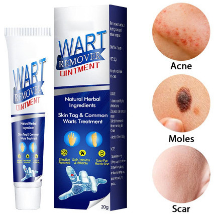 Wart Remover Ointment 20gm